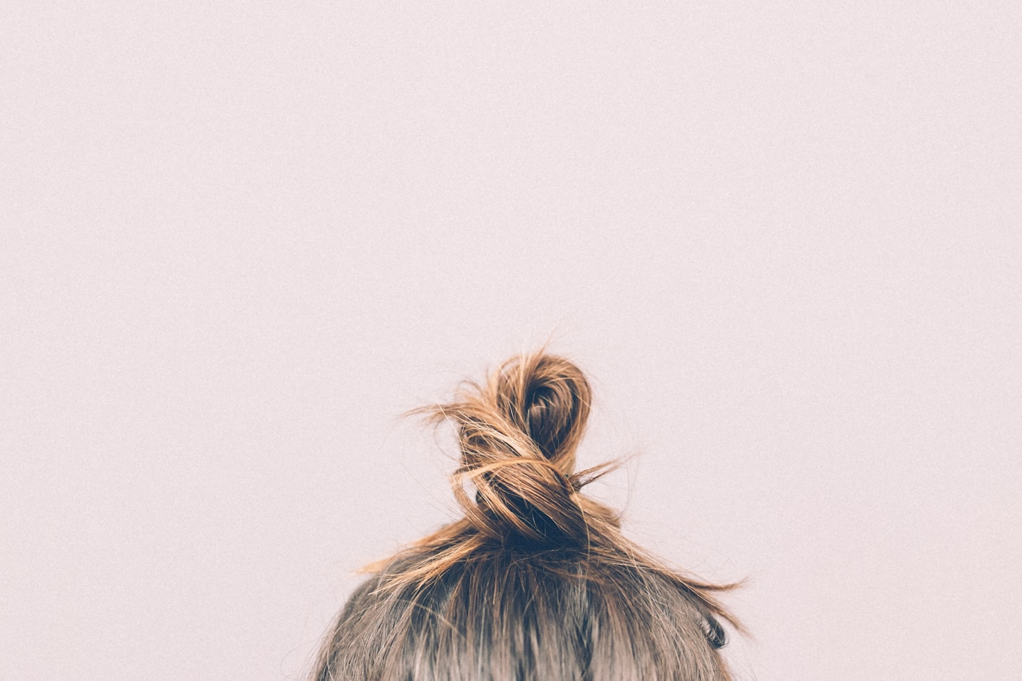 Comparing Hair Transplants Versus Non Surgical Solutions