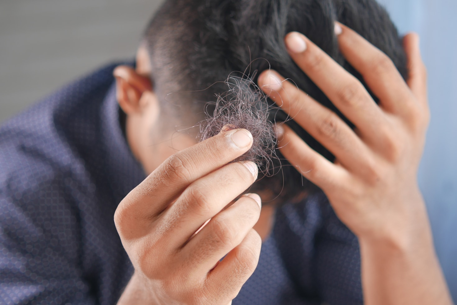Life Changing Benefits Of Modern Hair Procedures